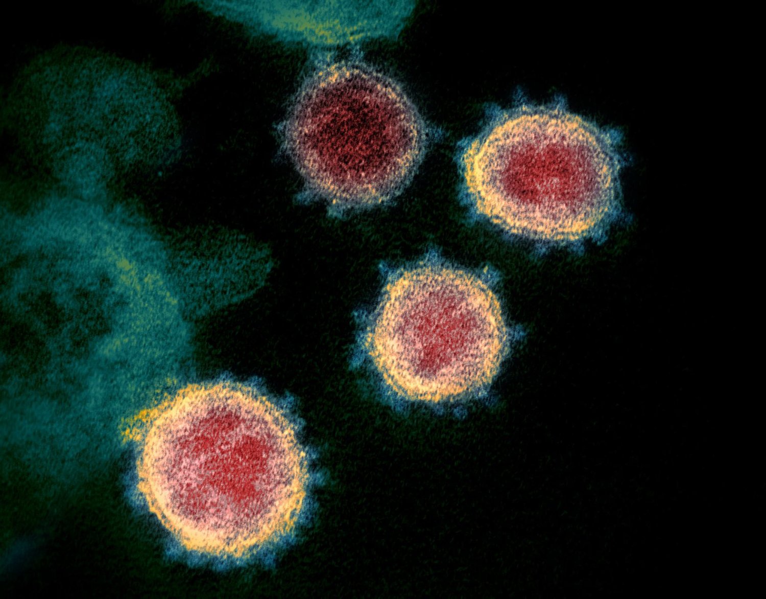 This is a new image of the novel coronavirus that causes COVID-19. The virus is now creating mutations that are spreading in the United States and elsewhere. Credit: National Institute of Allergy and Infectious Diseases, Rocky Mountain Lab