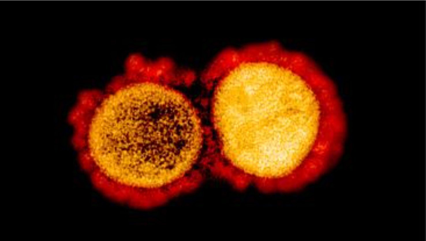 Novel coronavirus SARS CoV2, which causes COVID-19. Meanwhile, new COVID mutations called variants have spread across the U.S., including the newer Omicron variant.
MICROPHOTOGRAPHY BY NATIONAL INSTITUTE ON ALLERGY AND INFECTIOUS DISEASES.