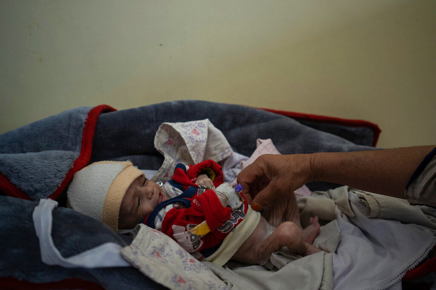 Emaciated children in Kabul hospital point to rising hunger - The ...