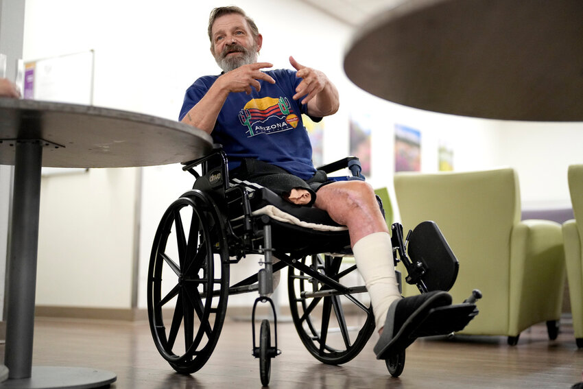 Ron Falk, 62, speaks of losing his leg, Tuesday, June 25, 2024 in Phoenix. (AP Photo/Matt York)