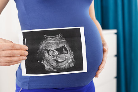 closeup pregnant woman holding ultrasound scan of baby