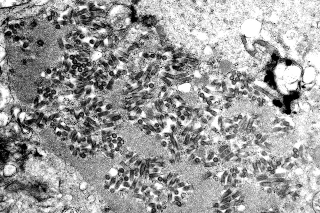 This electron micrograph shows multiple rabies viruses, dark and bullet-shaped, within an infected tissue sample...Rabies is a preventable viral disease of mammals most often transmitted through the bite of a rabid animal. The vast majority of rabies cases reported to the Centers for Disease Control and Prevention (CDC) each year occur in wild animals like raccoons, skunks, bats, and foxes. Domestic animals account for less than 10% of the reported rabies cases, with cats, cattle, and dogs most often reported rabid. . .Date:.XXXX.Content credits:./ xxxxx.Photo credit:.Xxxxxxxxxx.Image storage:.VEC/ GHO storage.Support File:.CD_128_DH/ 049..URL: .http://www.cdc.gov/ncidod/dvrd/rabies/.URL Title: .CDC – National Center for Infectious Diseases - Rabies ...ID#:.8341.Description:.Caption:.This transmission electron microscopic (TEM) image revealed the presence of numerous dark, bullet-shaped, rabies virions within an infected tissue sample..High Resolution:.Click here for hi-resolution image (4.72 MB).Content Providers(s):.CDC/ F. A. Murphy....