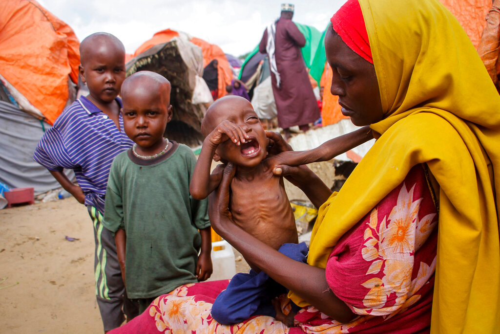 Maryan Madey, who fled the drought-stricken Lower Shabelle region, holds her malnourished daughter Deka Ali, 1, at a camp for the displaced on the outskirts of Mogadishu, Somalia Saturday, Sept. 3, 2022. (AP Photo/Farah Abdi Warsameh)