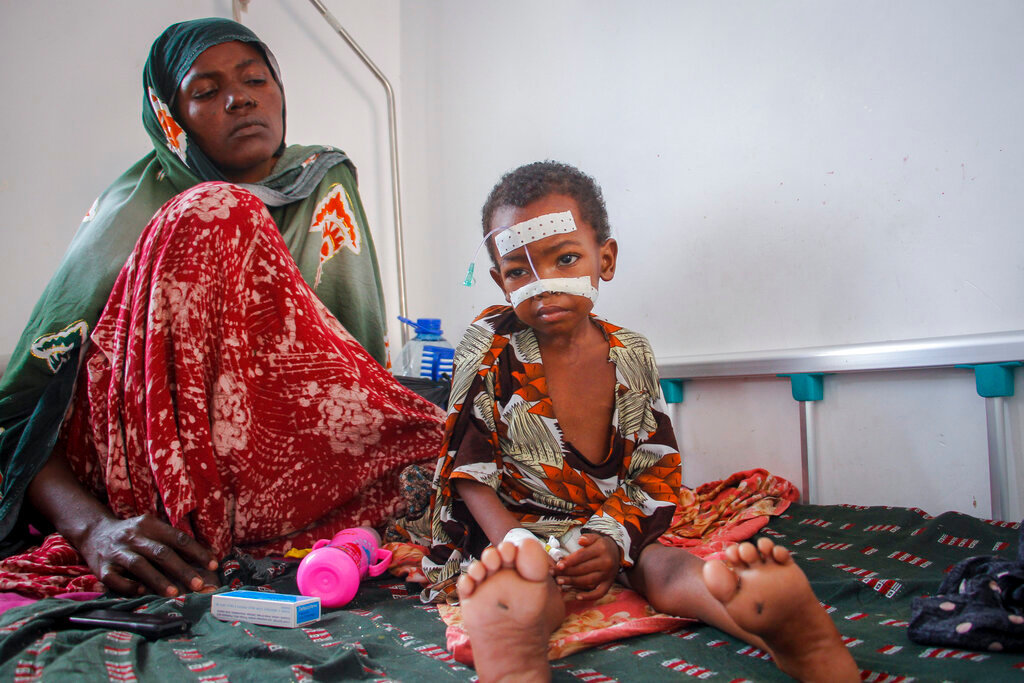 Malnourished Kalson Hussein, 4, sits next to her mother Isho Shukria, 35, at the Martini hospital where she is being treated in Mogadishu, Somalia Saturday, Sept. 3, 2022. (AP Photo/Farah Abdi Warsameh)