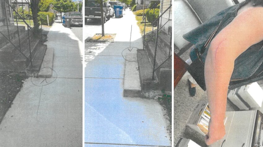 Photographs from the notice of claim show the protruding staircase on State Street leading to Water Street. Bristol resident Denise Procaccini suffered a dislocated arm and broken elbow as a result of tripping over the staircase in April.