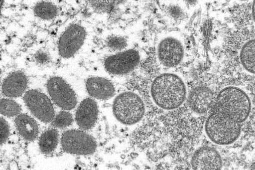 FILE - This 2003 electron microscope image made available by the Centers for Disease Control and Prevention shows mature, oval-shaped monkeypox virions, left, and spherical immature virions, right, obtained from a sample of human skin associated with the 2003 prairie dog outbreak. A leading doctor who chairs a World Health Organization expert group described the unprecedented outbreak of the rare disease monkeypox in developed countries as &quot;a random event&quot; that might be explained by risky sexual behavior at two recent mass events in Europe. (Cynthia S. Goldsmith, Russell Regner/CDC via AP, File)