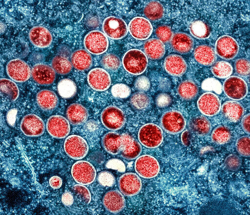 FILE - This image provided by the National Institute of Allergy and Infectious Diseases (NIAID) shows a colorized transmission electron micrograph of monkeypox particles (red) found within an infected cell (blue), cultured in the laboratory that was captured and color-enhanced at the NIAID Integrated Research Facility (IRF) in Fort Detrick, Md. On Friday, Aug. 12, 2022, The Associated Press reported on stories circulating online incorrectly claiming that monkeypox hasn't been detected in Georgia drinking water. The July 26 Atlanta-area news broadcast broadcast is being mischaracterized online to push the false claim that monkeypox has been found in residents&rsquo; tap water.  (NIAID via AP)