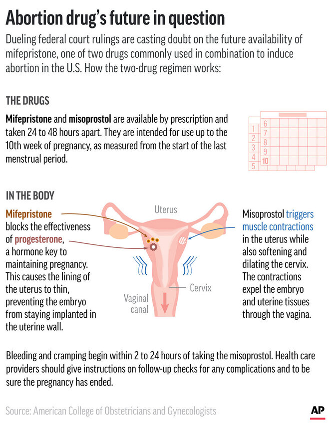 Two federal courts have issued contradictory rulings about whether a drug used as part of a medication abortion regimen should remain available. (AP Graphic)