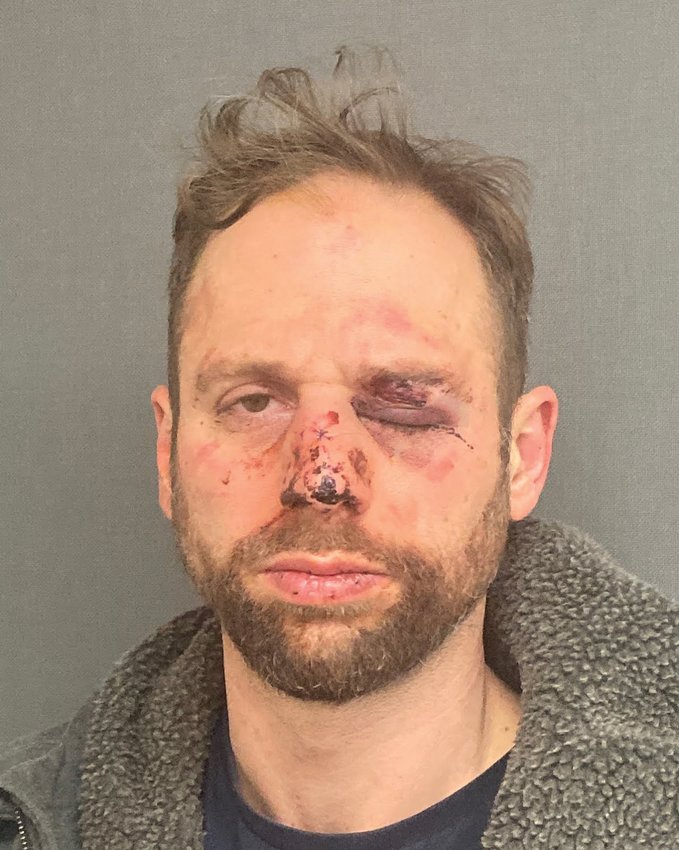 William Yediares, 39, of Johnston, has been charged with Resisting Arrest, Attempting to Elude, Cruelty to a Child, Gross Negligent Operation and Suspicion of DUI following a Vermont crash. Police allege Yediares fled their pursuit, while intoxicated and driving with an unrestrained child in the front seat.